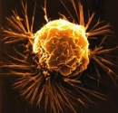 Ôxy làm chậm phát triển của khối u khi kết hợp với xạ trị